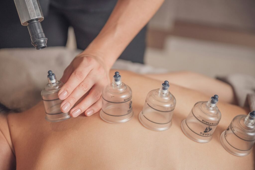 Masseur using cupping therapy on her client.